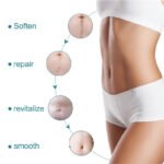 BUPY Scar Removal Patches - Image 5