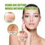 BUPY Scar Removal Patches - Image 4