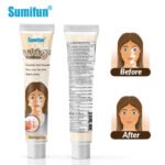 Sumifun Spot Removal Cream - Image 5