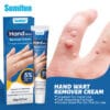 Sumifun Wart Removal Cream 05 Sumifun Wart Removal Cream