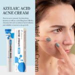 KORMESIC 20% Azelaic Acid Acne Cream - Image 4