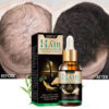 herbal hair growth serum