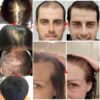 herbal hair growth serum