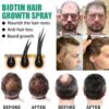 best hair serum for hair growth