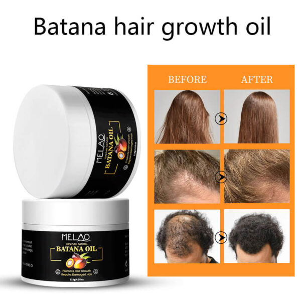 MELAO Batana Oil Hair Mask | 100% Natural Batana Oil | Deep Nourishing and Repairing Hair Treatment | 118g/4.16oz