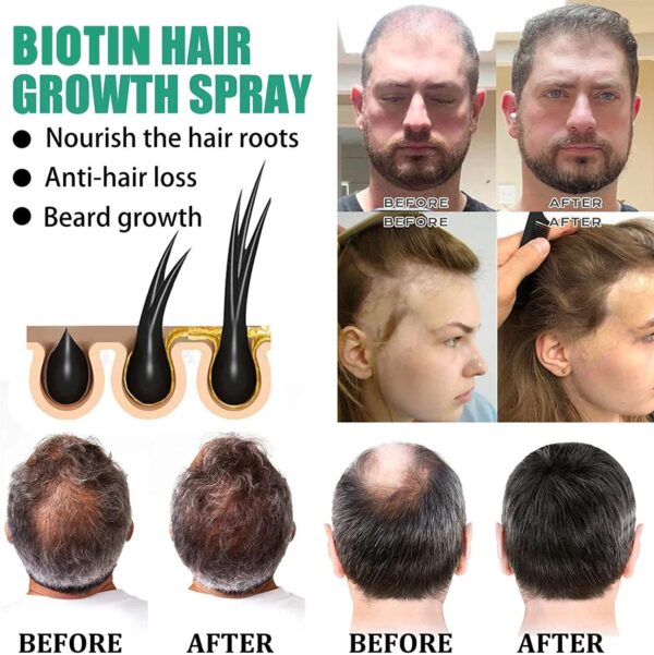 best hair serum for hair growth