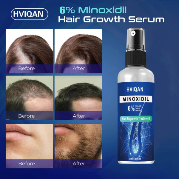 Hair Regrowth Serum