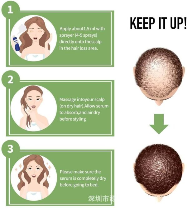 主图-4 iBeaLee Hair growth Spray | Ginseng, Black Sesame & Ginger Formula | Promotes Healthy Hair Growth, Anti-Hair Loss Serum | 0.7fl.oz/20ml