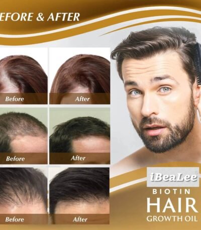 best hair growth serum for black hair