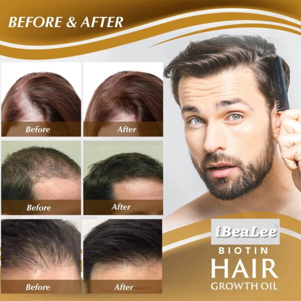 serum for hair growth