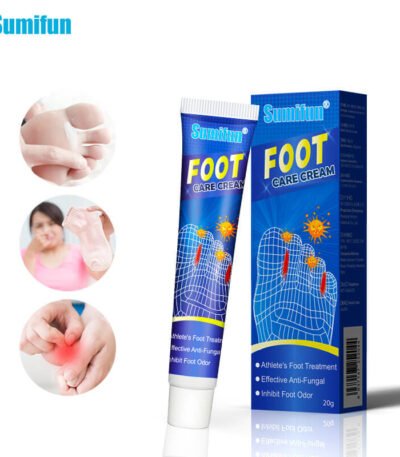 itch foot cream