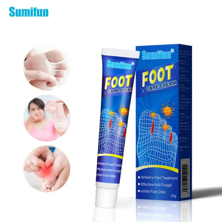 itch foot cream