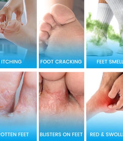 athlete's foot cream