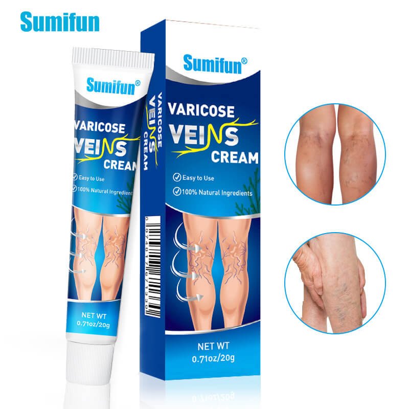 varicose veins cream