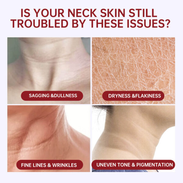 best cream for neck