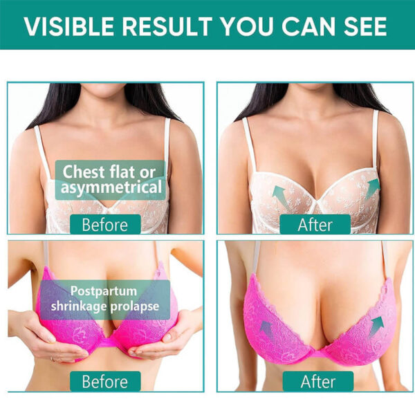 Flat chest