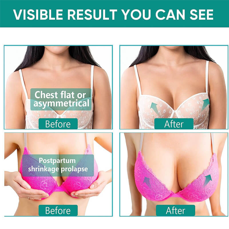 breast enhancing creams