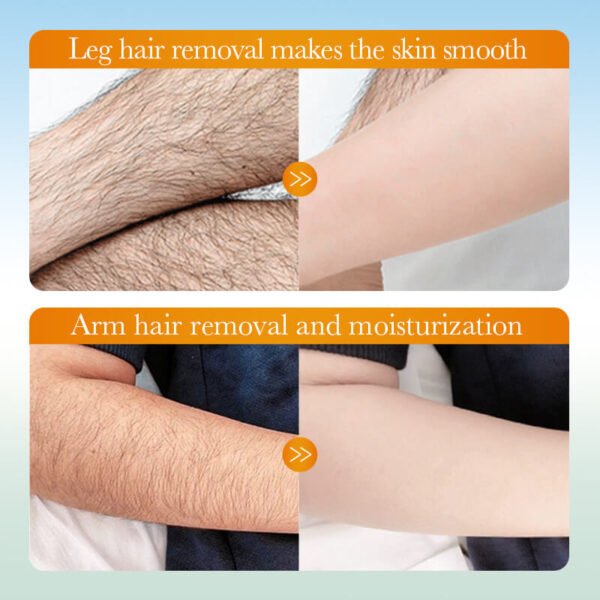 cream for hair removal