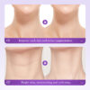 Reduce neck wrinkles