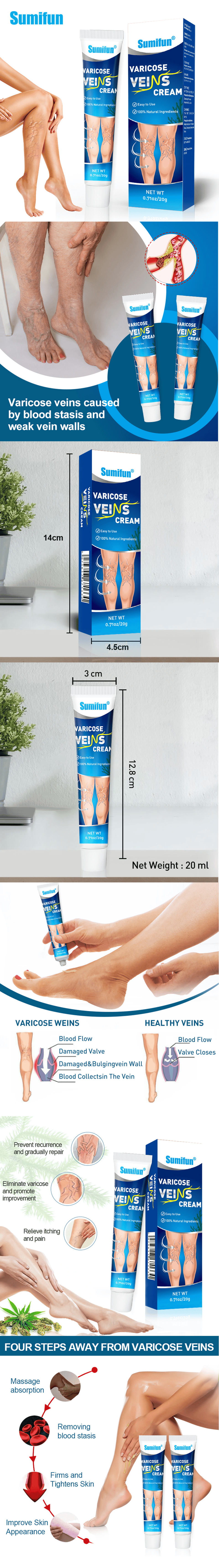 varicose cream