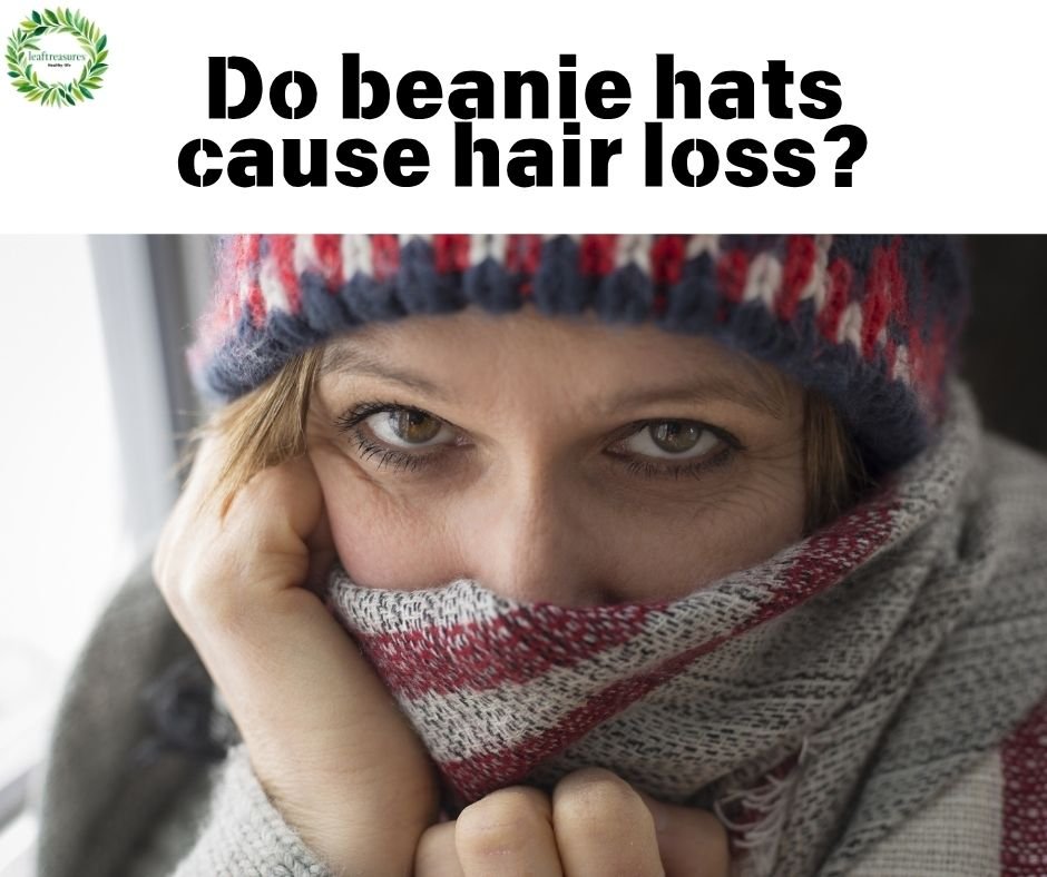 beanie hats cause hair loss