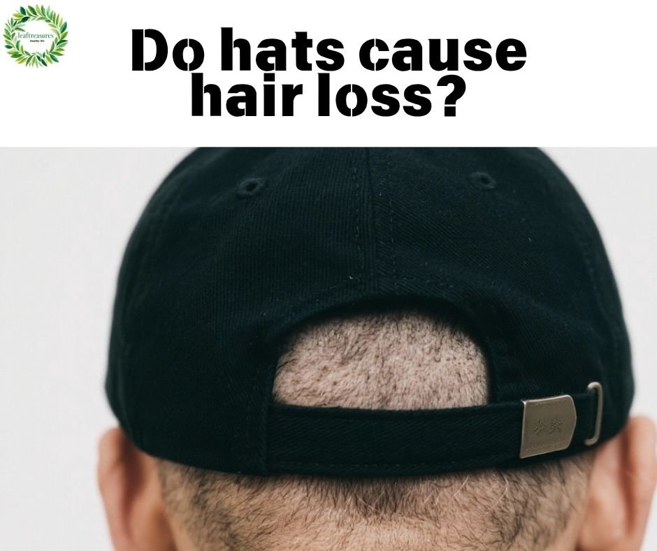 hats cause hair loss