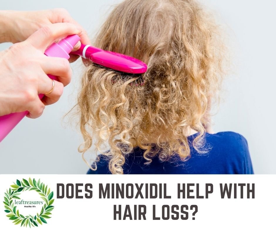 Does Minoxidil help with hair loss