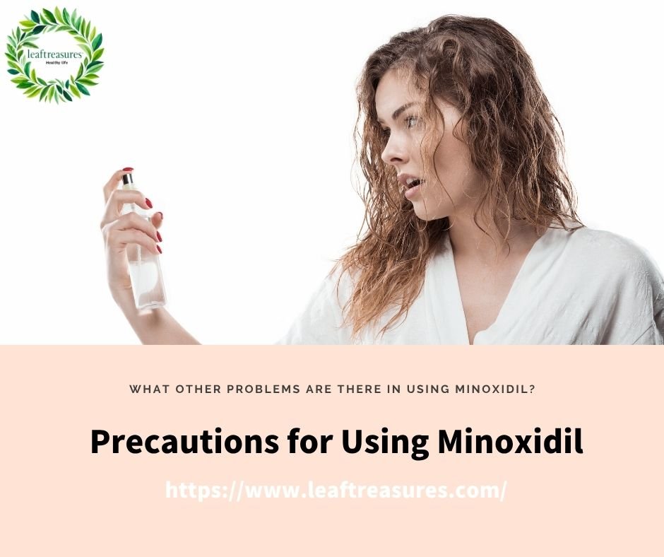 does minoxidil expire