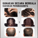 FLEXQW Polygonum Multiflorum Hair Growth Serum - Image 4