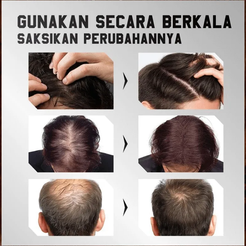 FLEXQW Polygonum Multiflorum Hair Growth Serum - Image 4