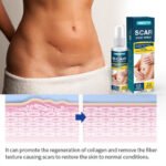 HBESTY Scar Remove Spray - Image 2