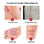 Kedunmao Scab Repair Gel - Image 4