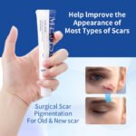 MEJISOO Scar Removal Cream - Image 4