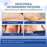MEJISOO Scar Removal Cream - Image 2