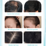 MELAO Castor Oil Hair Growth Serum - Image 5