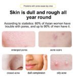 MOIKA Salicylic Acid Essence - Image 3