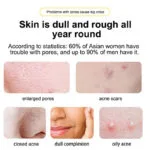 MOIKA Salicylic Acid Essence - Image 3