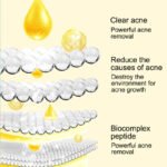 MOIKA Salicylic Acid Essence - Image 4