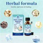 REVA Wart Removal Treatment - Image 4