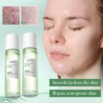 SADOER Salicylic Acid Skincare Kit - Image 4