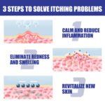 South Moon Psoriasis Relief Spray - Image 2