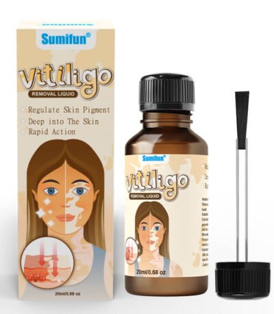 Sumifun Vitiligo Removal Liquid