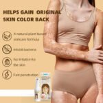 Sumifun Vitiligo Removal Spray - Image 4