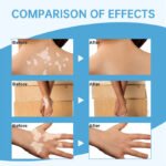 Sumifun Vitiligo Treatment Spray - Image 2