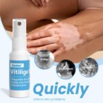 Sumifun Vitiligo Treatment Spray - Image 4