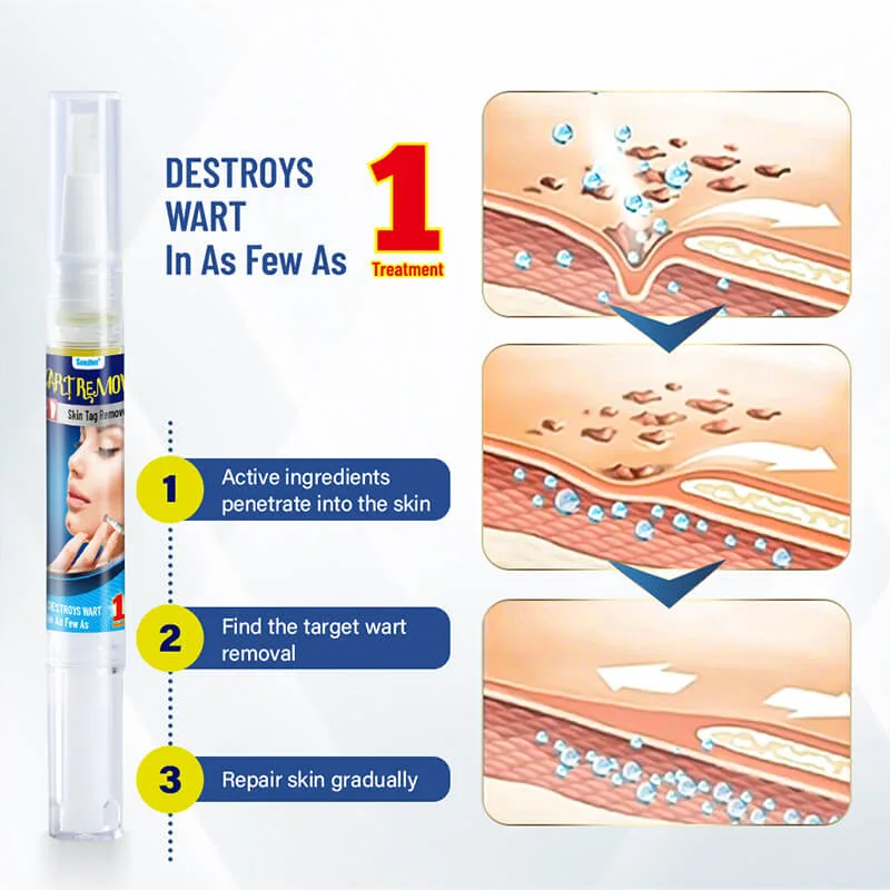 Sumifun Wart Remover Pen - Image 2