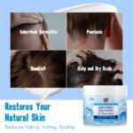 TUNMATE Seborrheic Dermatitis Cream - Image 3