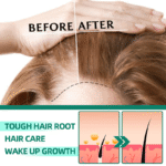 West & Month Thuja Orientalis Hair Growth Serum - Image 2