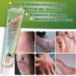 ZULANGZHONG Dermophyte Clearing Cream - Image 3