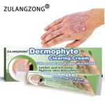 ZULANGZHONG Dermophyte Clearing Cream - Image 4